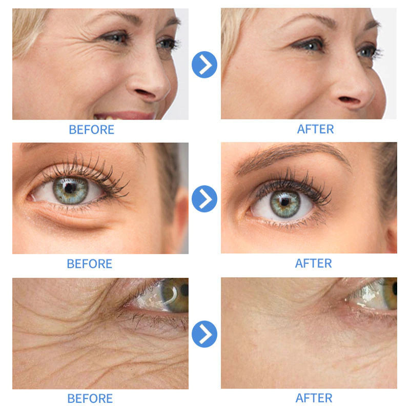 Retinol; anti-Aging Serum