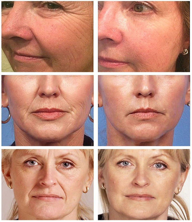 Retinol; anti-Aging Serum