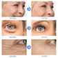 Retinol; anti-Aging Serum